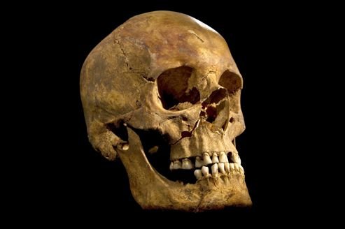 Crâne de Richard III(University of Leicester/AP)